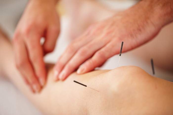 Azamara - Acupuncture.jpg